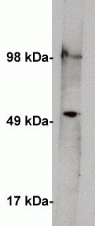  Western blot on human kidney lysate (10 ug/lane) using Exalpha’s anti Serine palmitoyltransferase 1 antibody (cat X2066P) at 1 ug/ml. Blot was developed using anti rabbit HRP at 1:75k and Pierce’s Supersignal West Femto. Exposure was 2 minutes.